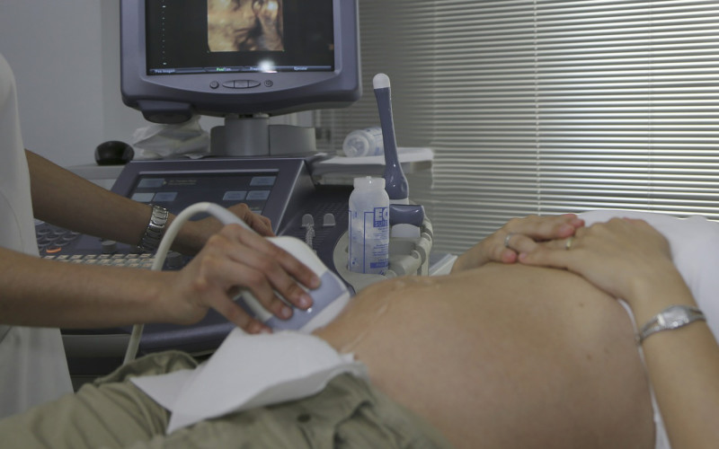 pregnancy ultrasound
