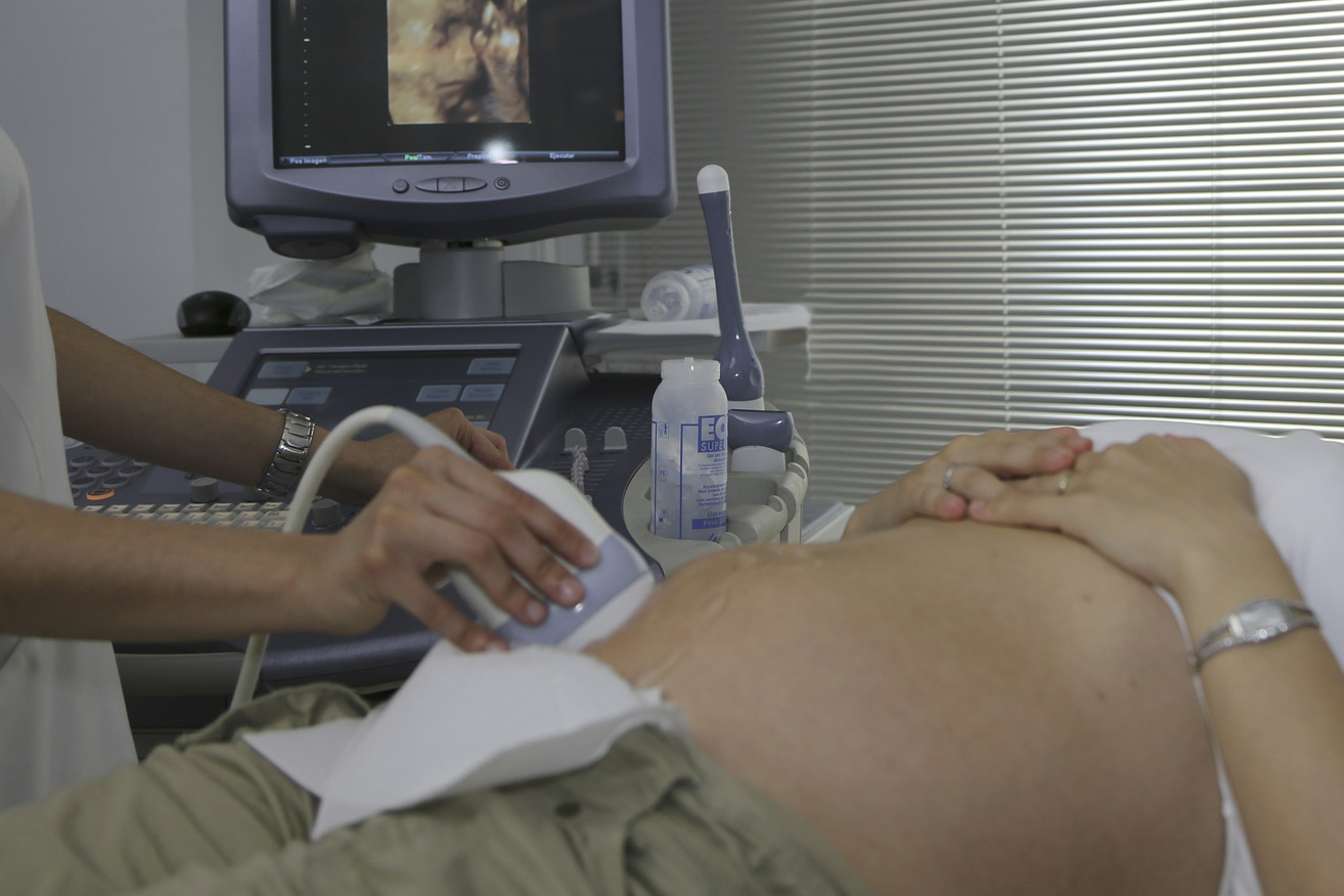 pregnancy ultrasound